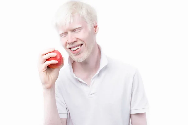 Albinismo Albino Homem Branco Pele Cabelo Estúdio Vestido Shirt Isolado — Fotografia de Stock