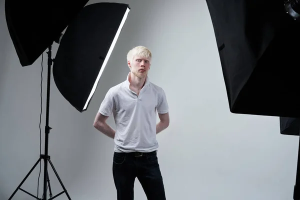 Albinisme Albinos Homme Peau Blanche Studio Habillé Shirt Debout Lumière — Photo