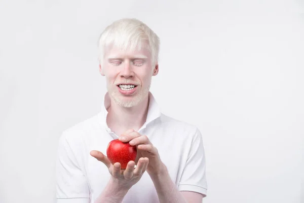 Albinismo Albino Homem Estúdio Vestido Shirt Isolado Fundo Branco Desvios — Fotografia de Stock