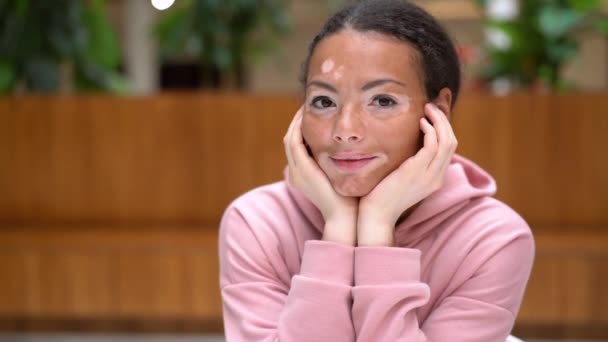 Noir afro-américain femme avec vitiligo pigmentation problème de peau intérieur habillé rose capuche couvrir visage mains sourire belle femelle — Video