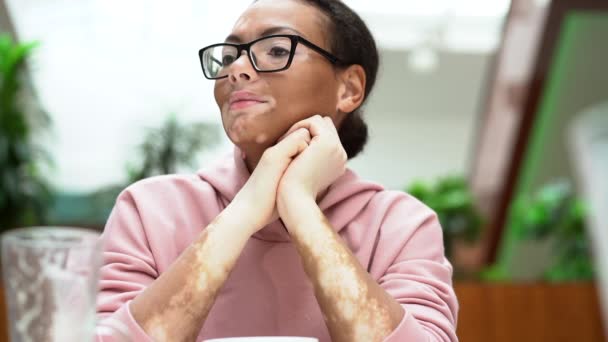 Black African American woman with vitiligo pigmentation skin problem indoor dressed pink hoodie — Stock Video
