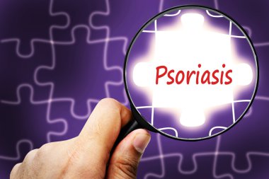 Psoriasis word. Magnifier and puzzles.