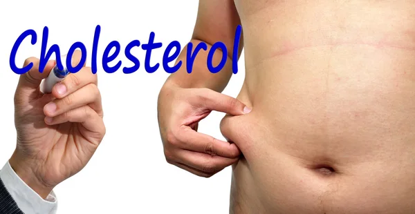 Palabra de colesterol cloud.Fat hombre comprobar su peso aislado — Foto de Stock