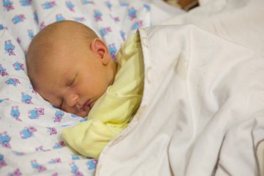 Jaundice in a newborn baby clipart