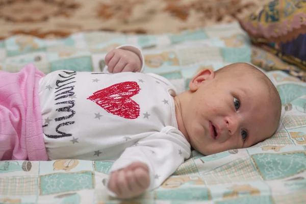 Hormonale huiduitslag bij pasgeborenen — Stockfoto