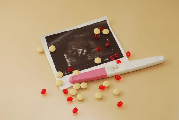 Ultraschallfilm des Fötus mit positivem Schwangerschaftstest auf beigem Hintergrund — Stockfoto