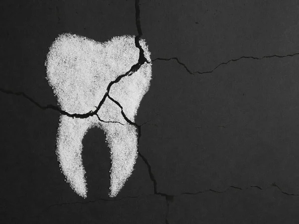Zucchero Danneggia Smalto Immagine Denti Zucchero Sfondo Nero Processo Distruzione — Foto Stock