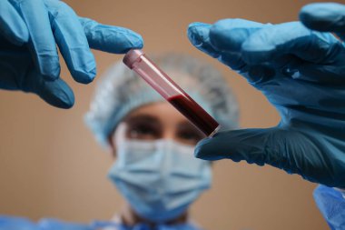 Bir hemşire, Çin, Wuhan 'dan alınmış koronavirüs pozitif kan örneği içeren bir test tüpü tutuyor. 2019 nCoV salgını. Coronavirüs 'ü durdurun. MERS. Bir virüs uzmanı koronavirüs aşısı düşünüyor. Grip, kuş gribi.