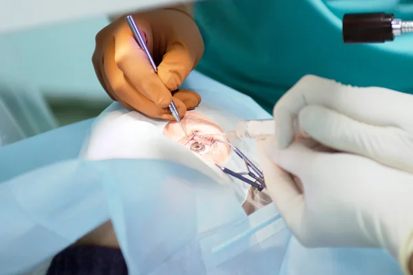 Lazer vizyon düzeltme