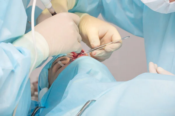 cerrahi burun şeklini değiştirmek için