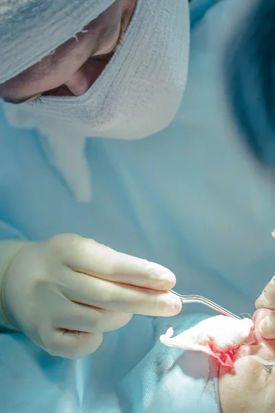 Справжня пластична хірургія для зміни форми носа — стокове фото