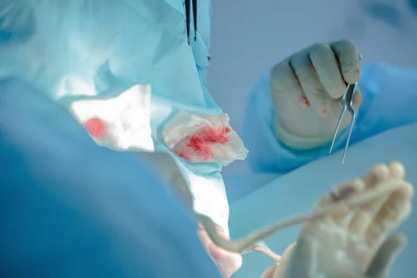 Echte plastische Chirurgie, um die Form der Nase zu verändern — Stockfoto