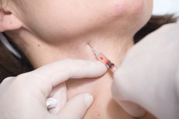 Kozmetik prosedürler fotoğrafı . 