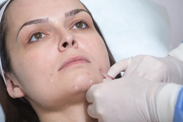 Kozmetik prosedürler fotoğrafı . 