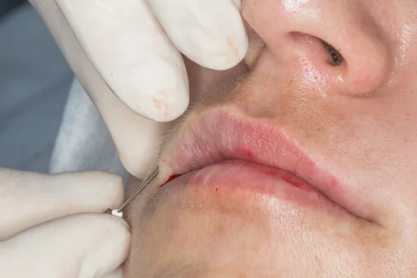 Kozmetik prosedürler fotoğrafı . 