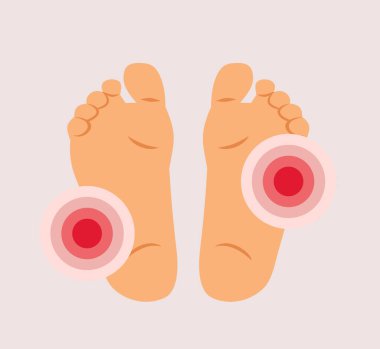 Yürüyen Vektör Resimlerinden Yaralı Ayak tabanları