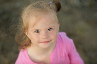 Sahilde Down sendromlu güzel bir kız.