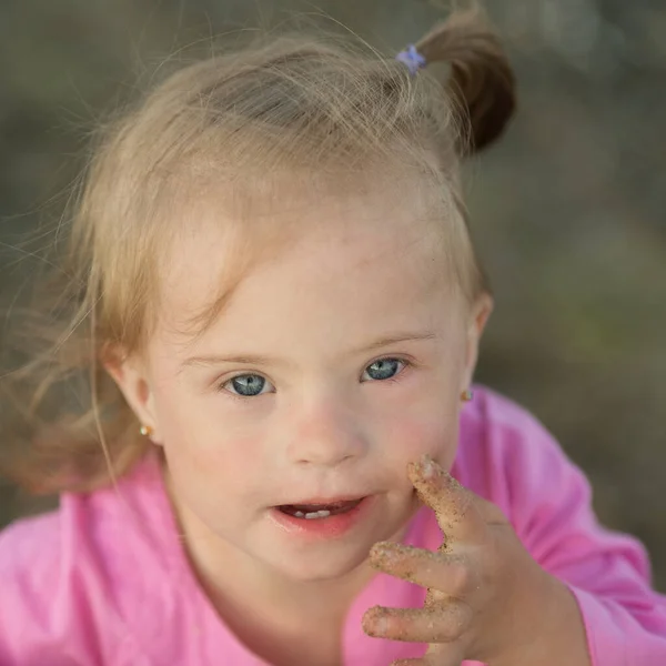 Schönes Mädchen Mit Syndrom Strand — Stockfoto