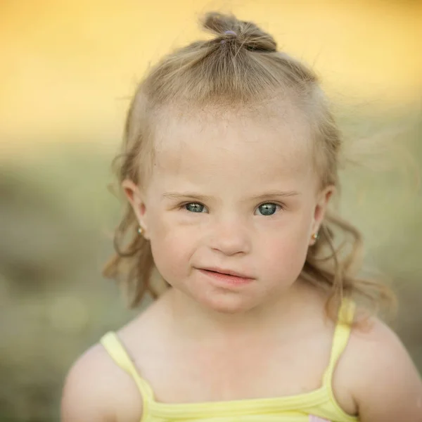 Bella Ragazza Con Sindrome Sulla Spiaggia — Foto Stock