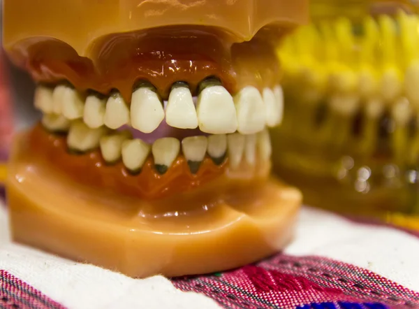 Le modèle des dents — Photo