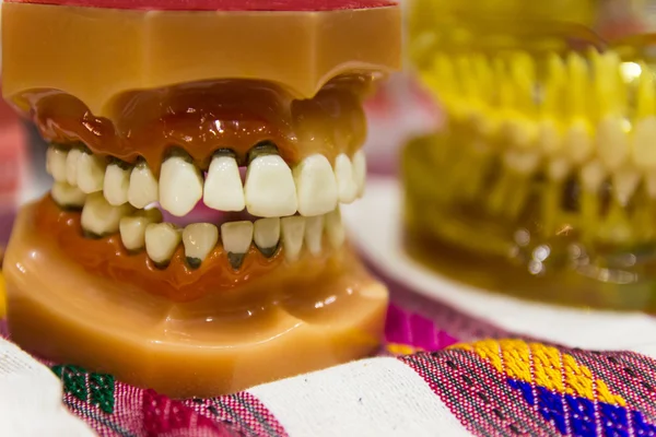 El modelo de dientes — Foto de Stock