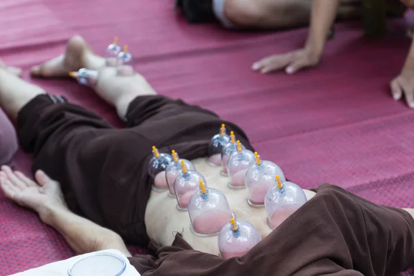 Jambe et le dos aspirateur de la peau, la médecine alternative chinoise — Photo