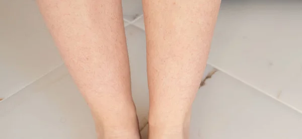 Neoholené Chlupaté Nohy Ženy Před Odstraněním Vlasů Koncept Hladké Pleti — Stock fotografie