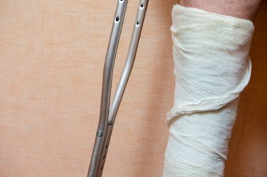 Tıbbi kavramlar ve fikirler. Ayaklarında alçı olan adamın koltuk değneklerini tutuşu. Yatay Görüntü