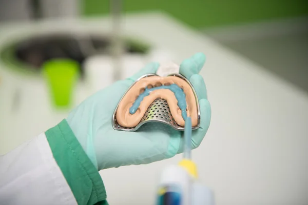 Closeup Shot Of Dental Impression With Implant — Stock Photo, Image