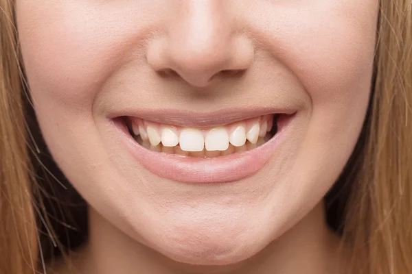 Sonrisa con dientes blancos y sanos . — Foto de Stock