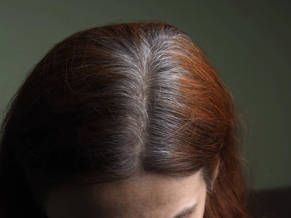 Cabeza Una Mujer Con Pelo Gris Teñido Con Henna — Foto de Stock