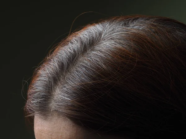 Cabeça Uma Mulher Com Cabelo Grisalho Tingido Com Henna — Fotografia de Stock