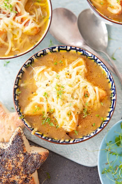 Fransk Löksoppa Med Bröd Och Smält Ost — Stockfoto