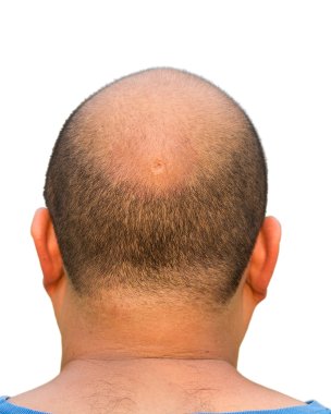 Bald head isolation clipart