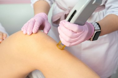 Profesyonel vücut bakımı kliniğinde bacak lazeri çıkarma prosedürünü kapatın. Elleri pembe eldivenli, elinde saç çıkarma makinesi var. Yatay bileşim. Lüks kozmetik epilasyon hizmeti 