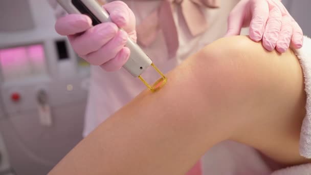 Haarentfernung Verfahren Videoaufnahmen Pulse Von Laserlicht Für Kosmetiksalon Zeitlupe Frauenbein — Stockvideo