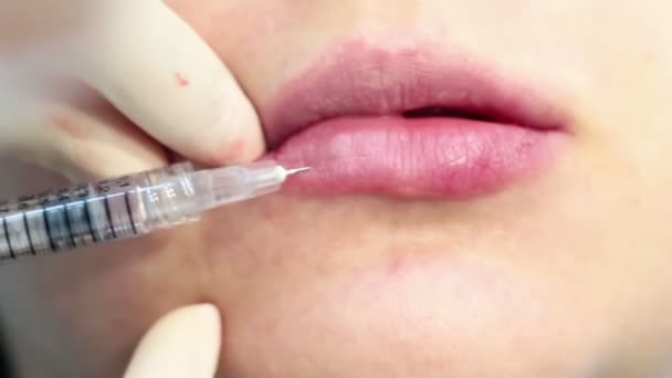 Lip Augmentation Hialuronic Acid Filler Injection Real Procedure Professional Cosmetology — Wideo stockowe