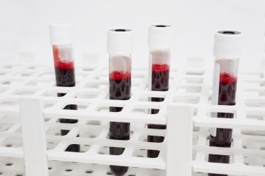 Kan örnekleri vardır analiz eder kapsayıcısında