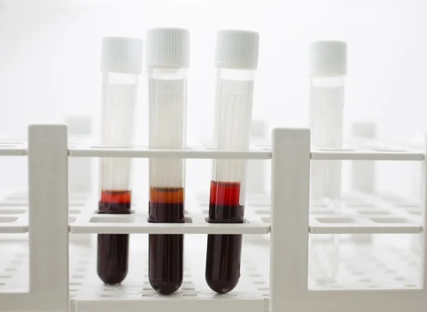 Las muestras de sangre se analizan en el recipiente — Foto de Stock