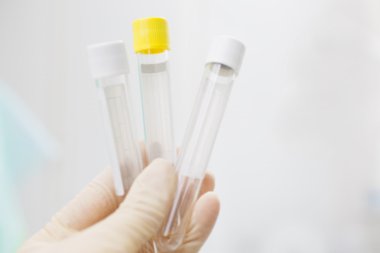 Kan test etme donanımları