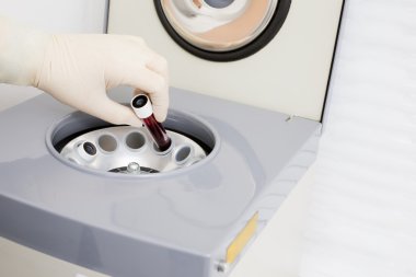 Enjeksiyon Plasmolifting için kan hazırlanması