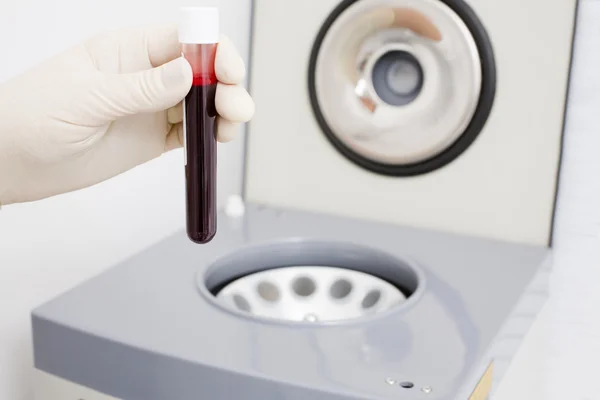 Preparación de la sangre para preparaciones inyectables — Foto de Stock