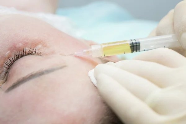 Injeções de rejuvenescimento antienvelhecimento — Fotografia de Stock