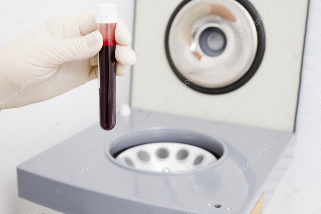 Preparation of blood for injections Plasmolifting