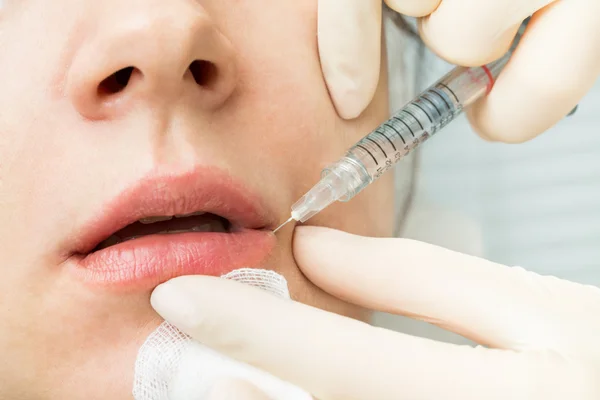 De echte procedure is de injectie van hyaluronzuur — Stockfoto