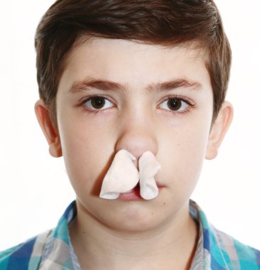  koyu kahverengi saçlı çocuk burun kanaması tampon var