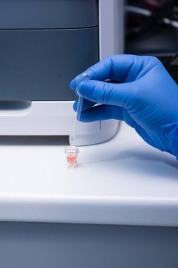 Biyokimya makinesinde analiz için kan serumunun hazırlanması