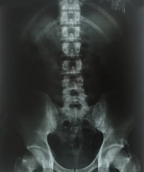 X-Ray — Stock Photo, Image
