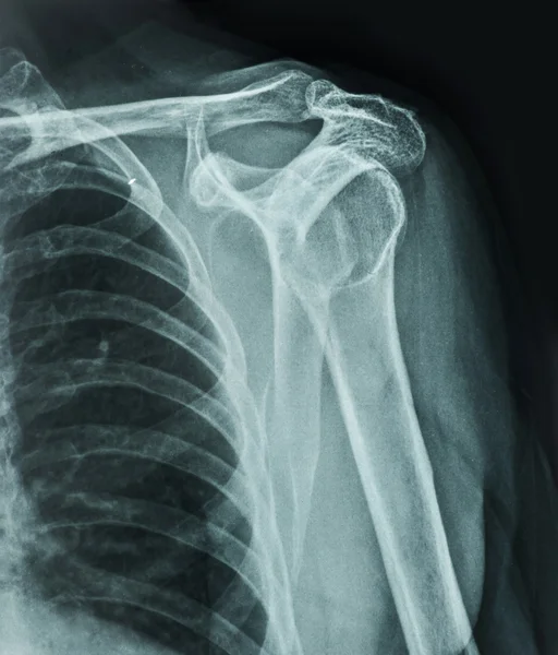 X-Ray — Stock Photo, Image