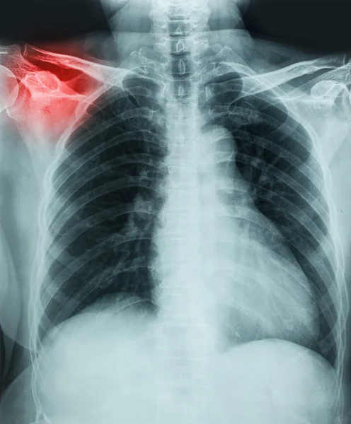 X-Ray — Stock Photo, Image